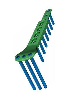 Ковзаюча пластина для педіатрії, з кутовою стабільністю, 5,0мм (mm) cплав титану 4 отвори, права ( Double Medical Technology Inc.)